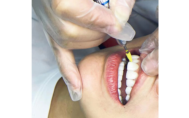 牙周治療/根管治療